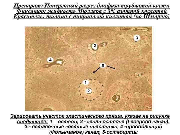 Препарат: Поперечный разрез диафиза трубчатой кости Фиксатор: жидкость Мюллера с 3% азотной кослотой Краситель: