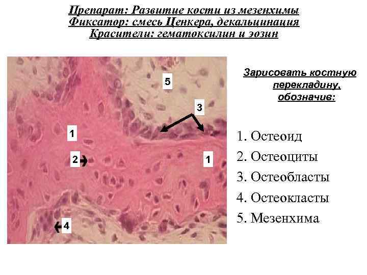 Препарат: Развитие кости из мезенхимы Фиксатор: смесь Ценкера, декальцинация Красители: гематоксилин и эозин Зарисовать