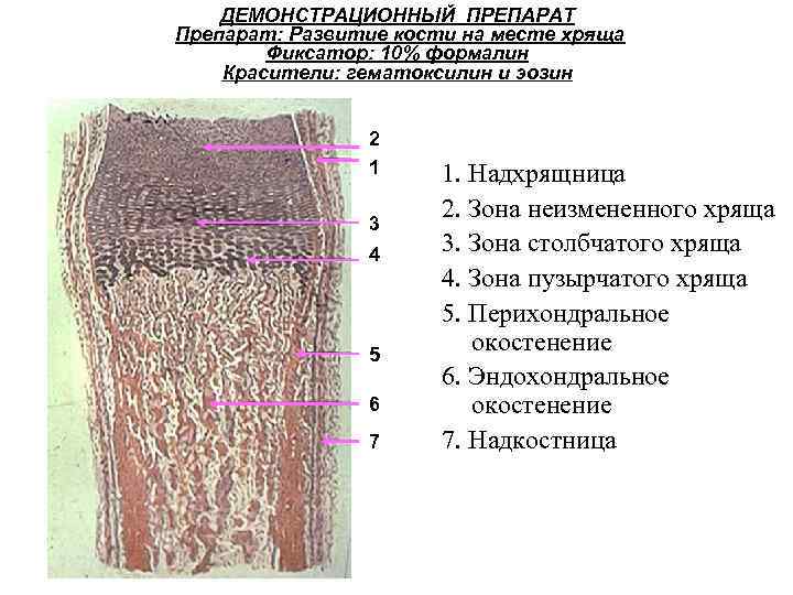 ДЕМОНСТРАЦИОННЫЙ ПРЕПАРАТ Препарат: Развитие кости на месте хряща Фиксатор: 10% формалин Красители: гематоксилин и