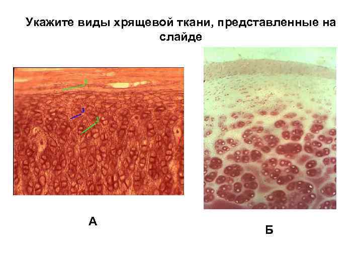 Укажите виды хрящевой ткани, представленные на слайде А Б 