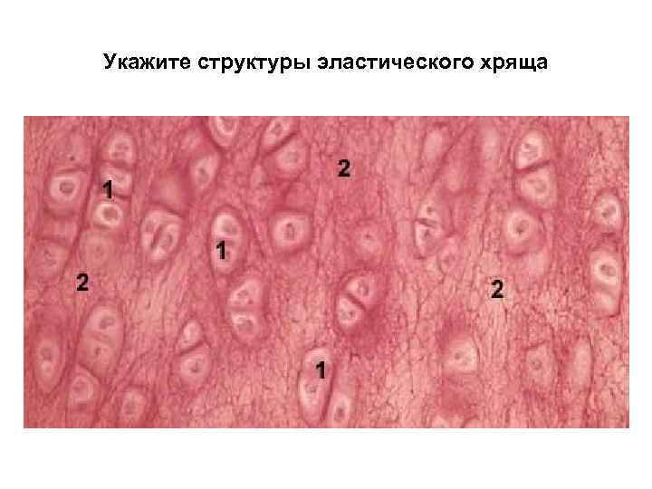 Укажите структуры эластического хряща 