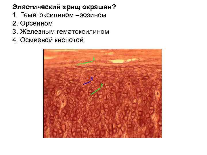 Эластический хрящ окрашен? 1. Гематоксилином –эозином 2. Орсеином 3. Железным гематоксилином 4. Осмиевой кислотой.