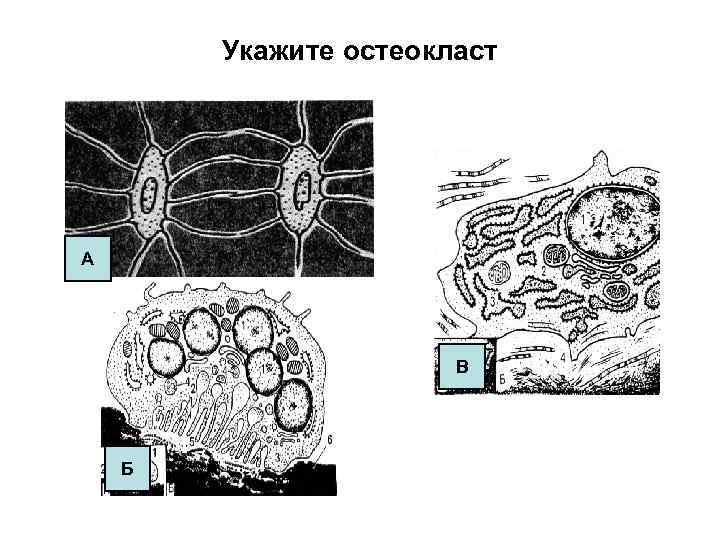 Укажите остеокласт А В Б 