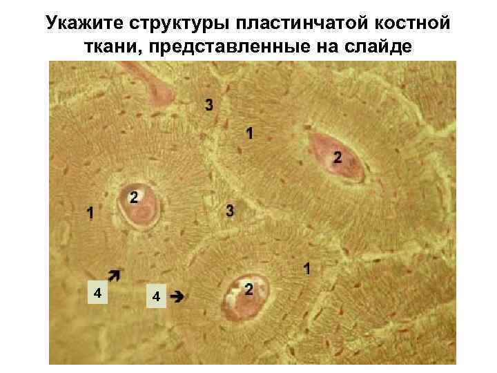 Укажите структуры пластинчатой костной ткани, представленные на слайде 4 4 