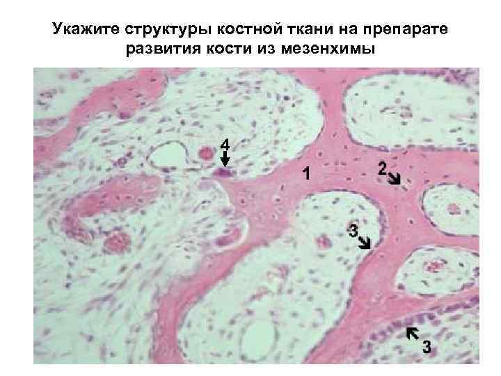 Укажите структуры костной ткани на препарате развития кости из мезенхимы 4 