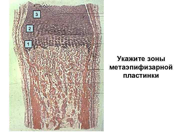 3 2 1 Укажите зоны метаэпифизарной пластинки 