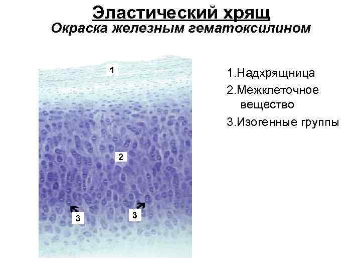 Эластический хрящ Окраска железным гематоксилином 1 1. Надхрящница 2. Межклеточное вещество 3. Изогенные группы