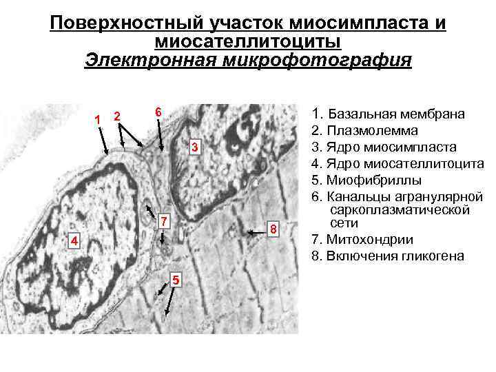 Поверхностный участок миосимпласта и миосателлитоциты Электронная микрофотография 1 2 1. Базальная мембрана 6 3