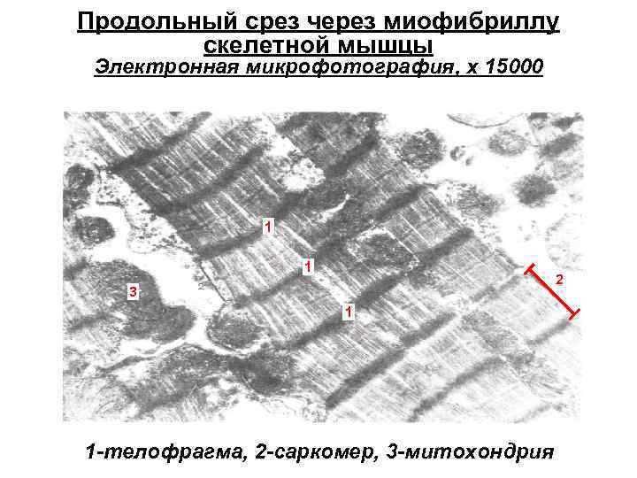 Продольный срез через миофибриллу скелетной мышцы Электронная микрофотография, х 15000 1 1 2 3