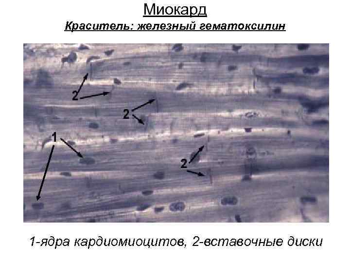 Сердечная мышечная ткань гистология рисунок