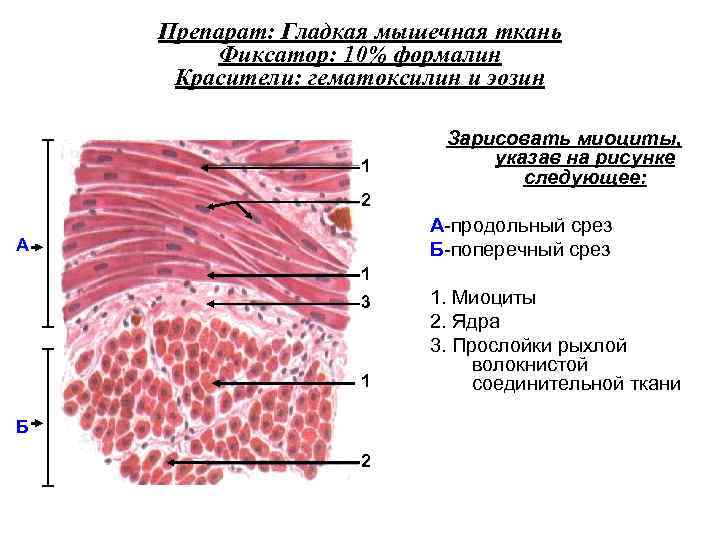 Гладкая мышечная ткань мочевого пузыря