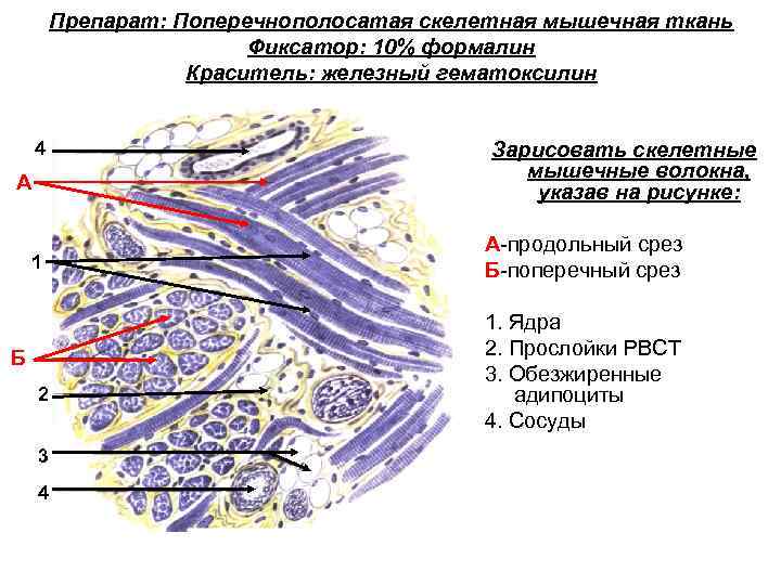 Поперечно полосатая мышечная ткань языка