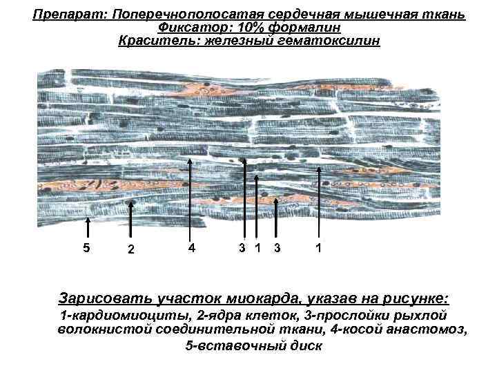 Особенности поперечно полосатой сердечной. Поперечнополосатая сердечная мышечная ткань препарат. Поперечно полосатая мышечная ткань Железный гематоксилин. Поперечнополосатая сердечная мышечная ткань гистология. Поперечно полосатая сердечная мышечная ткань Железный гематоксилин.