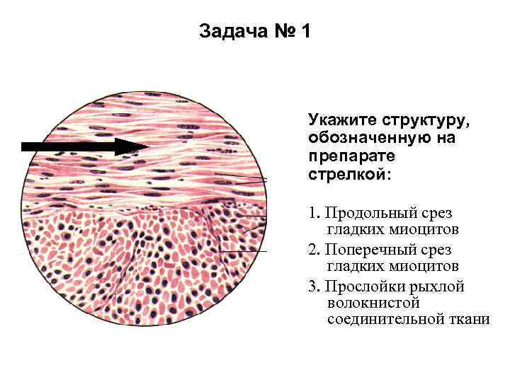 Задача № 1 Укажите структуру, обозначенную на препарате стрелкой: 1. Продольный срез гладких миоцитов