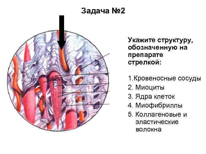 Задача № 2 Укажите структуру, обозначенную на препарате стрелкой: 1. Кровеносные сосуды 2. Миоциты