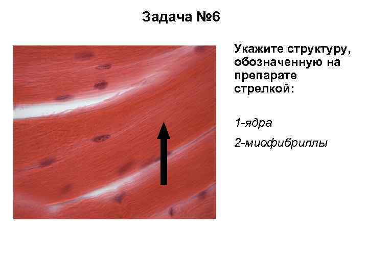 Задача № 6 Укажите структуру, обозначенную на препарате стрелкой: 1 -ядра 2 -миофибриллы 