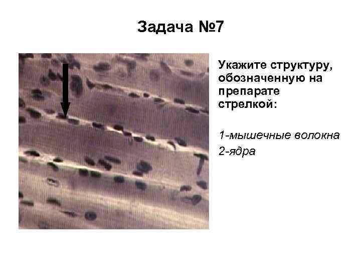 Задача № 7 Укажите структуру, обозначенную на препарате стрелкой: 1 -мышечные волокна 2 -ядра