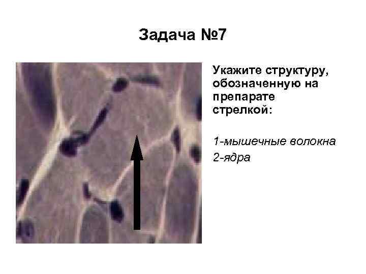 Задача № 7 Укажите структуру, обозначенную на препарате стрелкой: 1 -мышечные волокна 2 -ядра