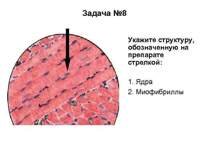 Задача № 8 Укажите структуру, обозначенную на препарате стрелкой: 1. Ядра 2. Миофибриллы 
