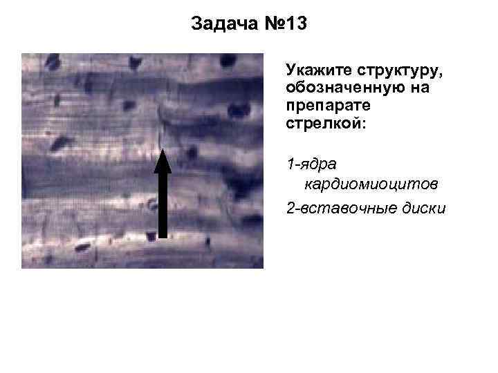 Задача № 13 Укажите структуру, обозначенную на препарате стрелкой: 1 -ядра кардиомиоцитов 2 -вставочные