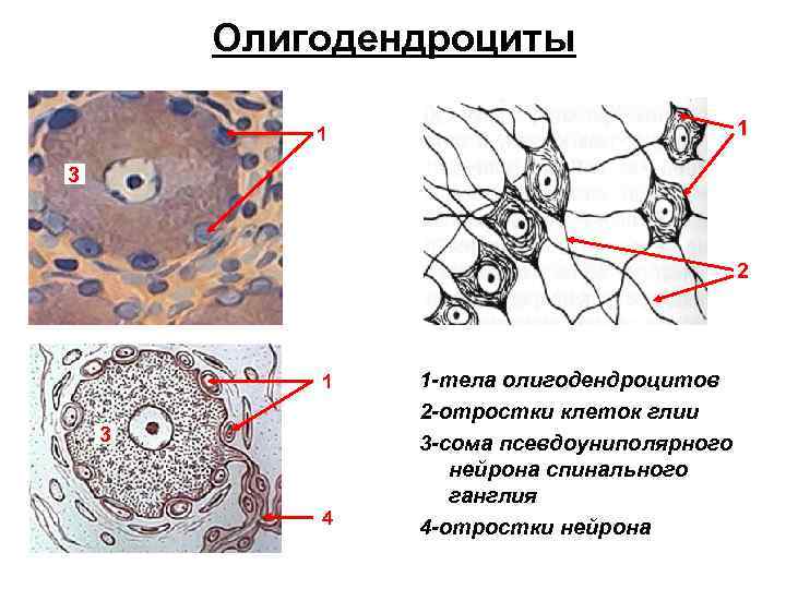 Олигодендроциты 1 1 3 2 1 3 4 1 -тела олигодендроцитов 2 -отростки клеток