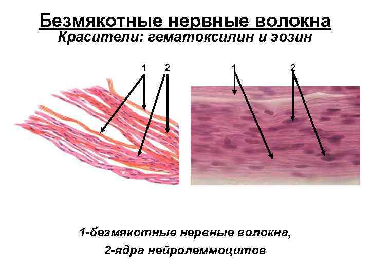 Безмякотные нервные волокна Красители: гематоксилин и эозин 1 2 1 -безмякотные нервные волокна, 2