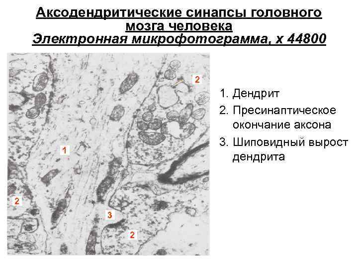 Аксодендритические синапсы головного мозга человека Электронная микрофотограмма, х 44800 2 1. Дендрит 2. Пресинаптическое