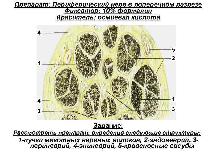 Препарат: Периферический нерв в поперечном разрезе Фиксатор: 10% формалин Краситель: осмиевая кислота 4 5