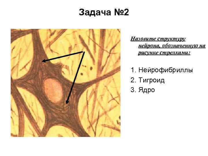 Задача № 2 Назовите структуру нейрона, обозначенную на рисунке стрелками: 1. Нейрофибриллы 2. Тигроид