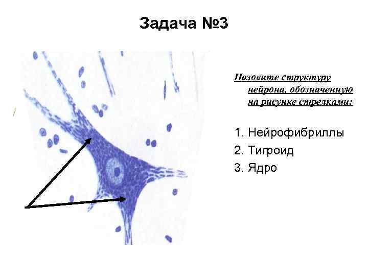 Задача № 3 Назовите структуру нейрона, обозначенную на рисунке стрелками: 1. Нейрофибриллы 2. Тигроид