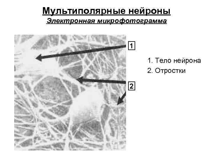 Мультиполярные нейроны Электронная микрофотограмма 1 1. Тело нейрона 2. Отростки 2 