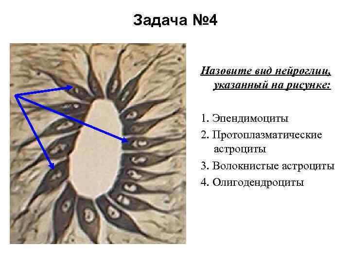 Задача № 4 Назовите вид нейроглии, указанный на рисунке: 1. Эпендимоциты 2. Протоплазматические астроциты