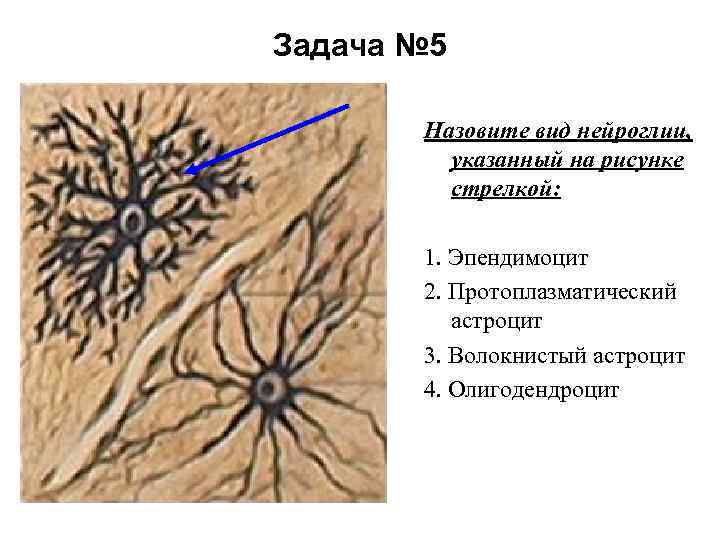 Задача № 5 Назовите вид нейроглии, указанный на рисунке стрелкой: 1. Эпендимоцит 2. Протоплазматический