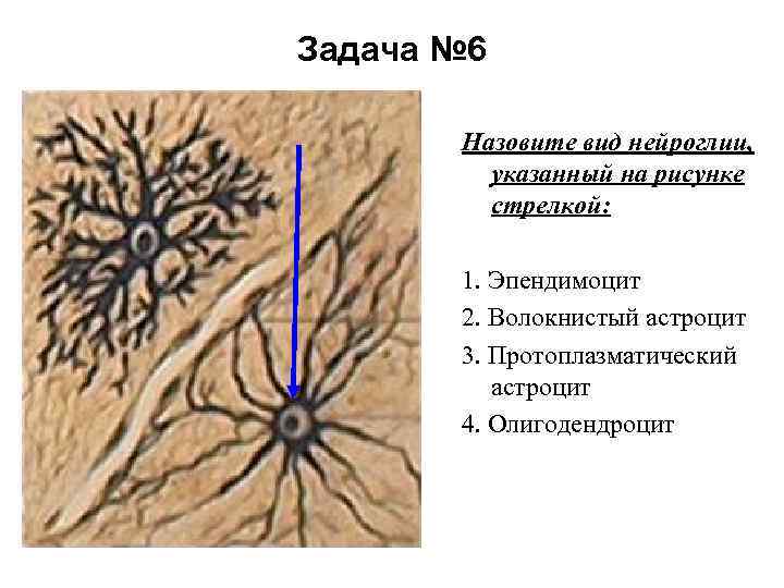 Задача № 6 Назовите вид нейроглии, указанный на рисунке стрелкой: 1. Эпендимоцит 2. Волокнистый