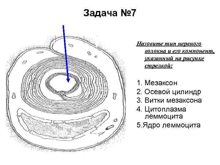 Задача № 7 Назовите тип нервного волокна и его компонент, указанный на рисунке стрелкой: