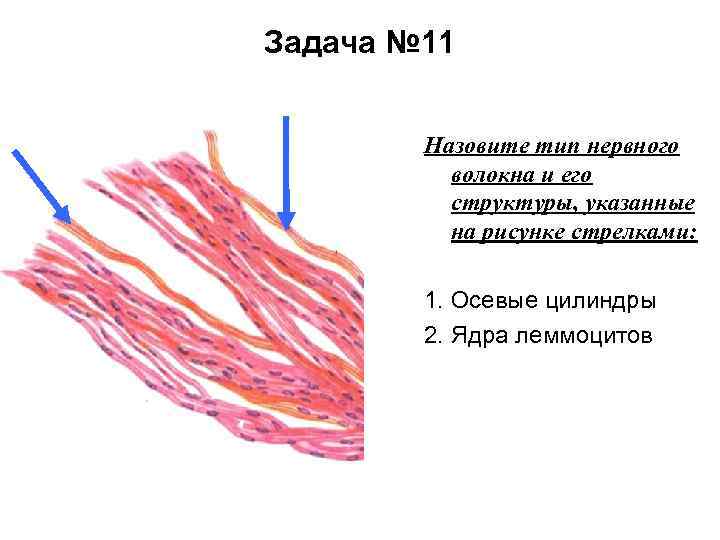 Задача № 11 Назовите тип нервного волокна и его структуры, указанные на рисунке стрелками: