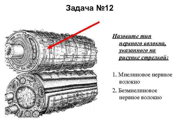 Задача № 12 Назовите тип нервного волокна, указанного на рисунке стрелкой: 1. Миелиновое нервное