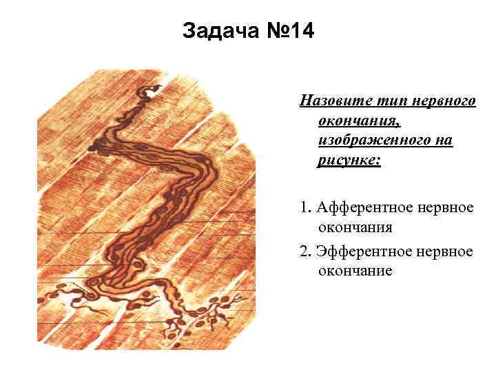 Задача № 14 Назовите тип нервного окончания, изображенного на рисунке: 1. Афферентное нервное окончания