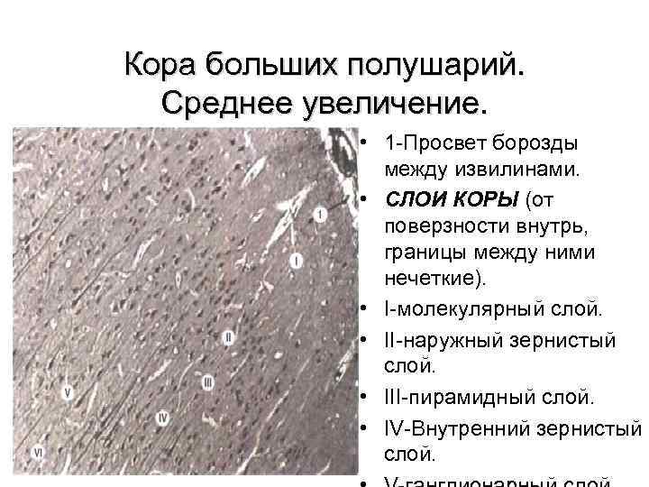 Кора больших полушарий гистология препарат рисунок