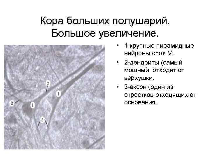 Кора больших полушарий. Большое увеличение. • 1 крупные пирамидные нейроны слоя V. • 2