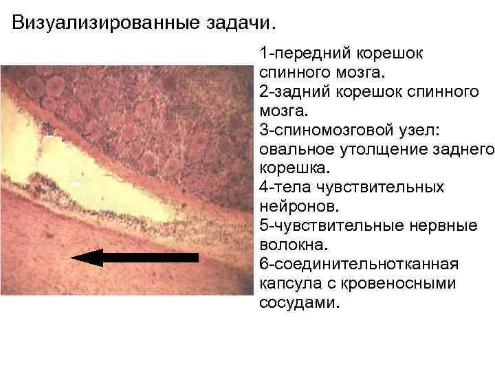 Визуализированные задачи. 1 передний корешок спинного мозга. 2 задний корешок спинного мозга. 3 спиномозговой