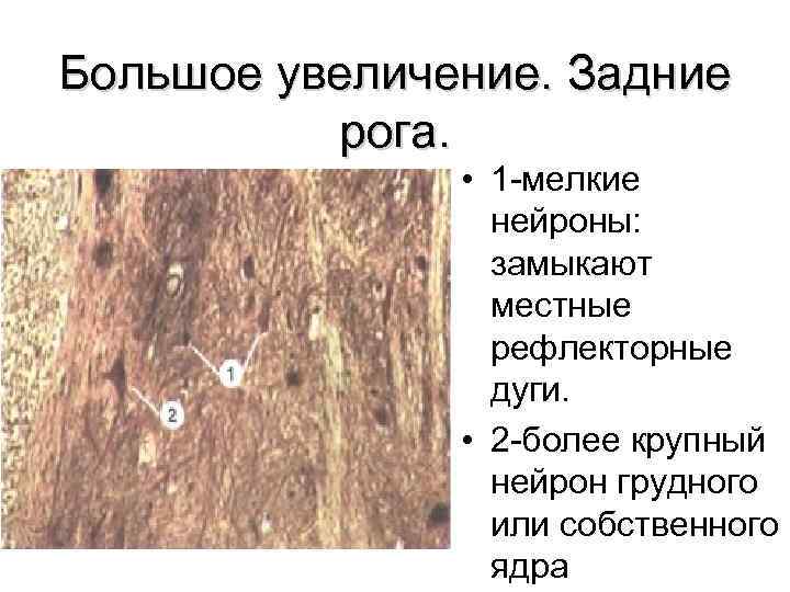 Большое увеличение. Задние рога. • 1 мелкие нейроны: замыкают местные рефлекторные дуги. • 2