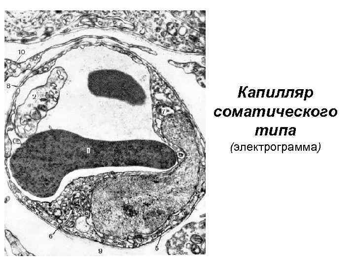 Капилляр соматического типа (электрограмма) 