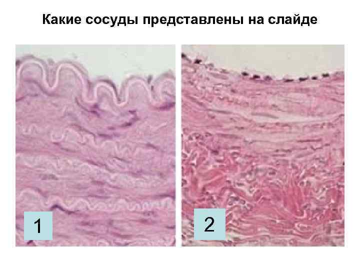 Какие сосуды представлены на слайде 1 2 