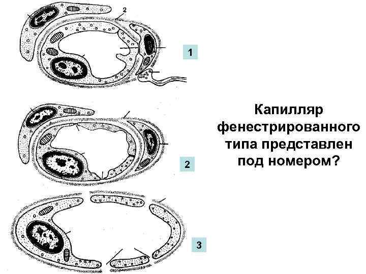 1 Капилляр фенестрированного типа представлен под номером? 2 3 