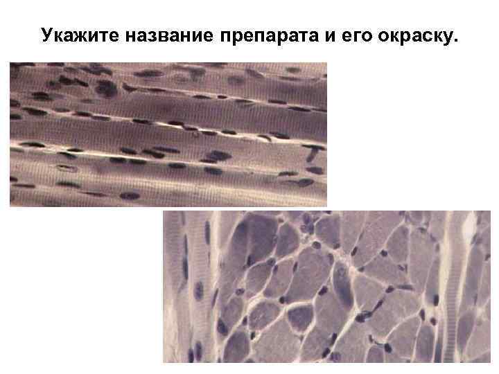 Укажите название препарата и его окраску. 