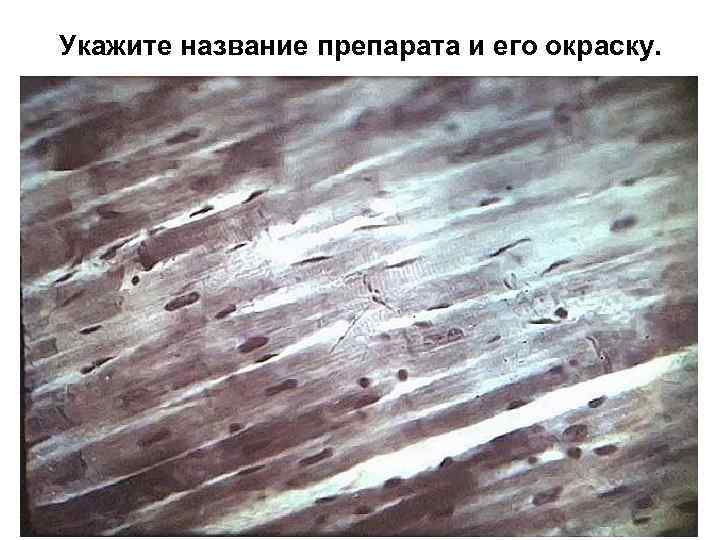 Укажите название препарата и его окраску. 