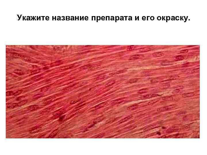 Укажите название препарата и его окраску. 