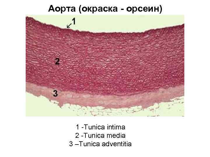 Аорта (окраска - орсеин) 1 -Tunica intima 2 -Tunica media 3 –Tunica adventitia 