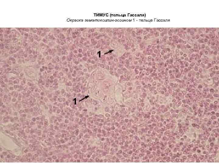 ТИМУС (тельца Гассаля) Окраска гематоксилин-эозином 1 - тельце Гассаля 
